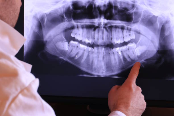 Best Emergency Dental Surgery in Alamo, NV